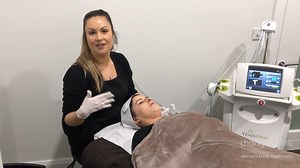 1K views | Venus Viva Fractional Skin Resurfacing *Reduce open pores *Reduce acne scarring *Reduce redness *Reduce fine lines & wrinkles *More even complexion *Smoother tighter skin https://www.changesclinic.ie/venus-viva-fractional-rf/ | Changes Clinic | Facebook