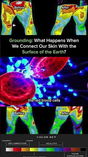 Earthing Movie - What Happens When We Connect Our Skin With The Surface Of The Earth