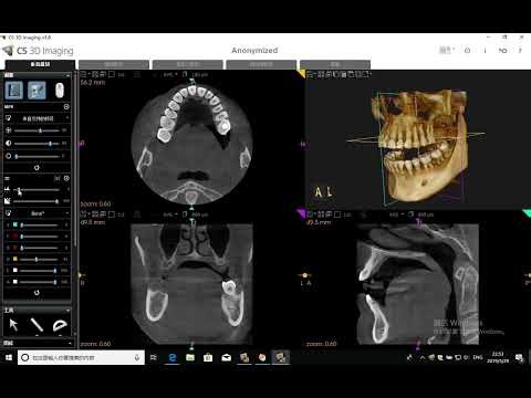 Lesson 2: CS 3D Interface & CBCT Multi-View Navigation