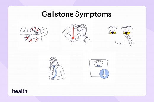 5 Symptoms of Gallstones To Tell Your Doctor About