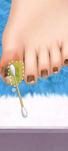 Deep Foot Cleaning ASMR 😳 | So Satisfying Transformation 👣 #ASMR #FootCare #DoctorGame #SatisfyingVideo #FootCleaning #ASMRIndia #RelaxingSounds #OddlySatisfying #DoctorASMR #FootSpa #DeepClean #ReelItFeelIt #SatisfyingReels #CleaningASMR | ASMR