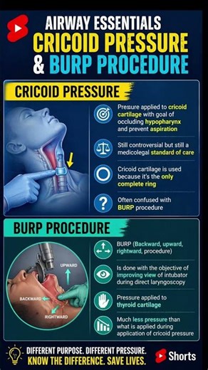 Cricoid Pressure vs BURP Procedure 🔥 Must Know Difference!Airway Management Trick You MUST Know 💉