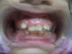 Sistema Trainer - Caso tratado com T4K - Dr. Paulo Faria