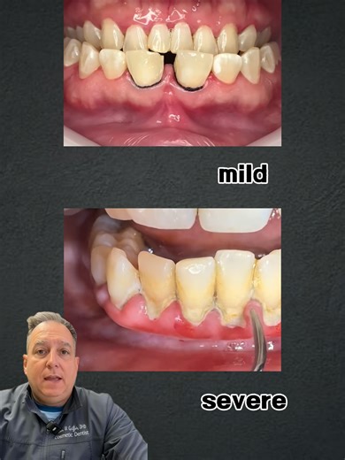 VEbanlER Nature Oral Care Toothpaste Review