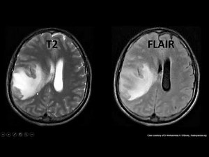 MRI Sequences in a easy explanation