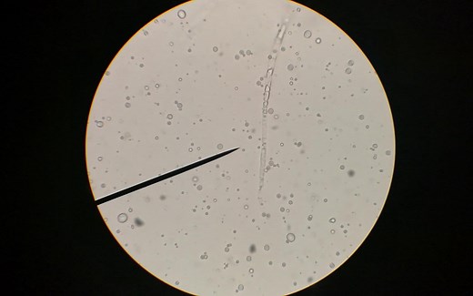 【微生物】腐霉的菌丝和游动孢子