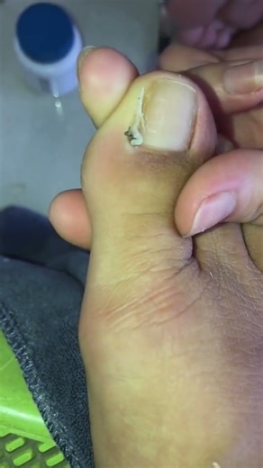 Nail cleaning 💅 #nailcare #satisfying #nails