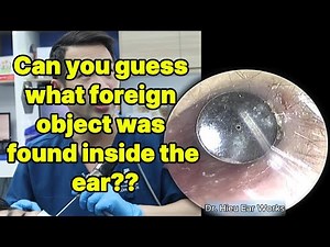 Can you guess what foreign object was found inside | ear cleaning | ASMR earwax | soothing |relax|