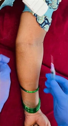 Blood 🩸 collection technique #blood #reels #shorts #world #training #health #feed #diagnosis #view