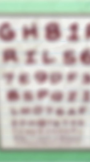 18K views · 477 reactions | Eye Troubles! #animation #motionpicture #digitalart #digitalartist #sketch | Pencilmation | Facebook