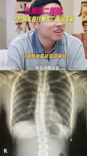 The Hidden Dangers of Long-Term Leg Crossing & How to Avoid Them