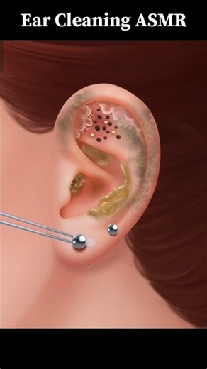 Deep Ear Cleaning and Ear Wax Removal | Relaxing Sounds #asmr #earcleaningasmr