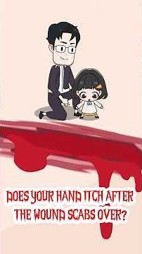 209 - Does your hand itch after the wound scabs over? #GardenofKnow