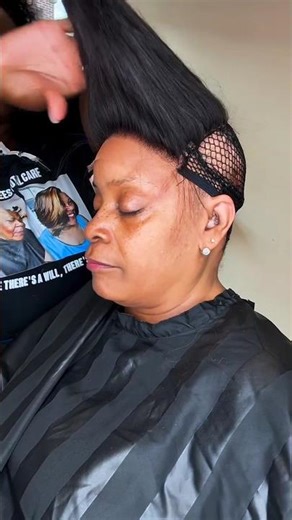 Damaged Hair Repair | Alopecia Recovery Story