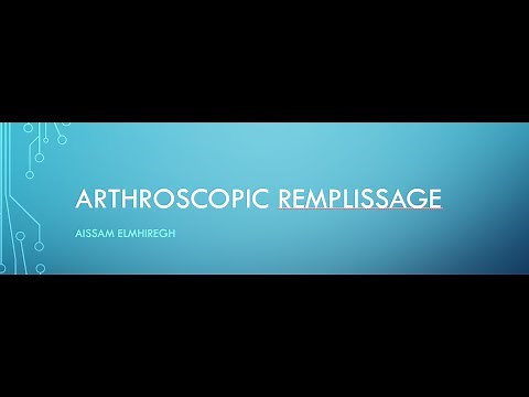 Arthroscopic Remplissage Procedure