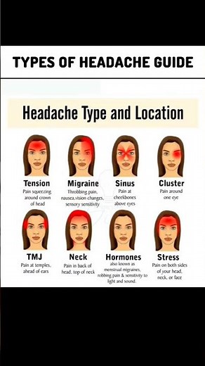 #tiktokgame#trending #eyes #funny #youtubeshorts #memes #marriage