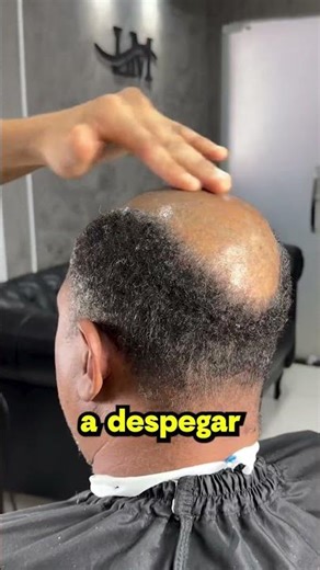 The barber discovers the fake hair 💇‍♂️