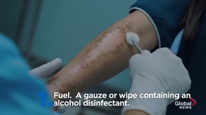 How a surgical fire starts