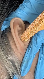 1.9M views · 5.6K reactions | Strange material removed from ear This original video was produced by Rick Lax and Alex Z. | Silly Skits & Sentimental Scenes | Facebook