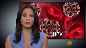 Preventing cancer with HPV vaccine