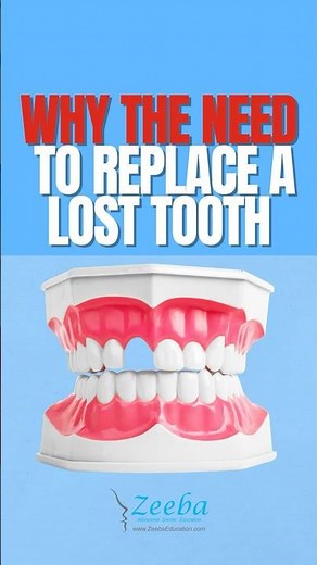 👉 Why You Should Replace a Lost Tooth | Risks of Tooth Loss Explained