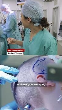 28-year-old man donates part of his brain for research