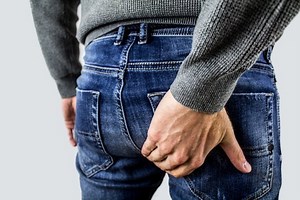 My Patient Perspective: What to Expect From Hemorrhoid Removal Surgery