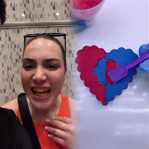 Keemokazi pulls hilarious prank using yellow teeth filter 😂#shorts