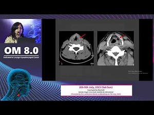 Imaging anatomy and common pathology of larynx and hypopharynx| Diva Shah| OM 8