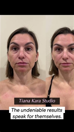 This isn't a facial. It's why everyone is talking about Face Up. #shorts