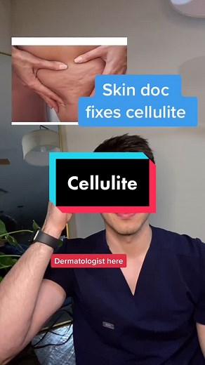 fix cellulite? (Weak) evidence for topical treatment! More on IG and in my book! #cellulite #coffee #caffeine #retinoids #fy #fyp #skincare #lifehack