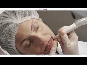 amiea lip micropigmentation treatment done by Sonja Laake - Permanent Makeup