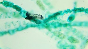 Conjugation Spirogyra Under Microscope Sexual Reproduction: Video có sẵn (100% miễn phí bản quyền) 8886280 | Shutterstock