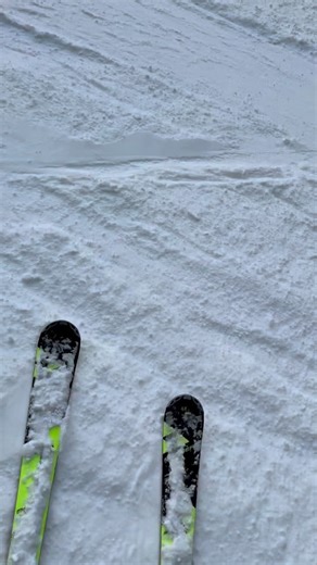 Przypominam, aktywność fizyczna jest ważna 😜😀 #zdrowie #lekarz #health #doctor #dbajosiebie❤️ | Dr Tadeusz