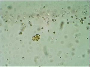 Algae - Under the Microscope