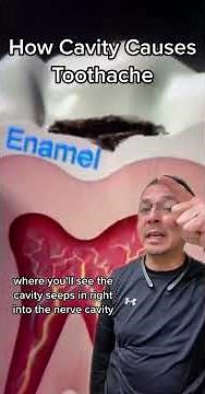 What Causes a Toothache? Tooth Decay (Cavities) | View Mobile Dental