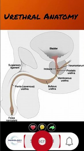 RGU test 🥺 Retrograde urethrography