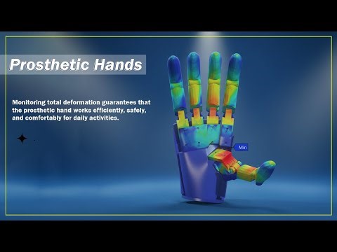 What Is Total Deformation in Prosthetics? | The Secret Behind Smart Hand Efficiency