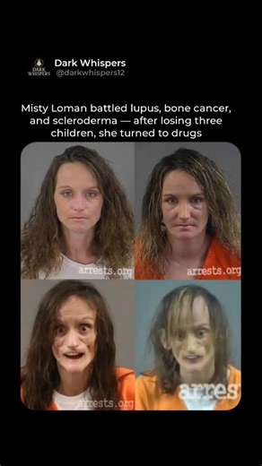 Dark Whispers on Instagram: "Misty Loman’s photos shocked the internet with her transformation. She battled lupus, bone cancer, and scleroderma — illnesses that ravaged her. After losing three children, she spiraled into grief. In desperation she turned to drugs, accelerating her decline. Her mugshots captured the toll of pain and addiction. What many assumed was “just drugs” was also relentless disease. Her story is a reminder that behind every viral photo is a human life."