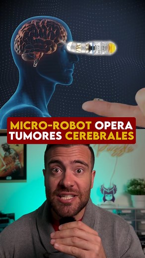 Javier Angulo on Instagram: "Este micro-robot puede operar tumores en el cerebro🧠🤖 Aunque parece un simple grano de arroz, en realidad es un robot microscópico creado por la startup francesa Roboté, diseñado para navegar dentro del cerebro humano y eliminar tumores hasta ahora imposibles de operar. ¿Cómo lo hace? Con anillos rotatorios de silicona, se mueve cuidadosamente a través del tejido cerebral a una velocidad de 3 mm por minuto, sin causar daño alguno. Todo esto guiado por una inteligen