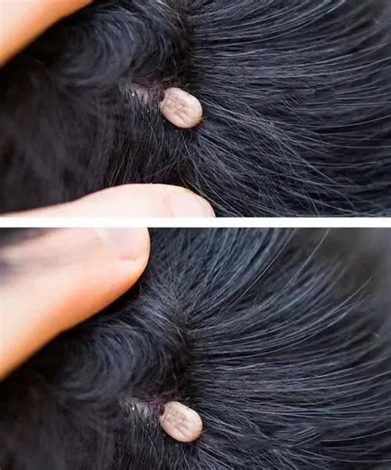 ❌Just discovered this in my son's hair. What is it? Not sure if we should go to doc. Full article in 1st comment😱👇 | Laughing until it hurts and you can not breathe