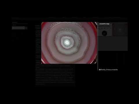 Swarming Motility of Proteus mirabilis - Microbiology