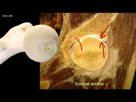 Femoral neck fracture - applied anatomy