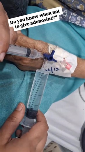 Muneer Jan on Instagram: "ADENOSINE (SVT KILL SWITCH) Adenosine is not a “gentle” drug. It’s a diagnostic and therapeutic weapon—and if you don’t respect it, it will embarrass you in front of your team. WHAT IT DOES • Transiently blocks AV node conduction • Interrupts re-entrant SVTs (AVNRT, AVRT) • Ultra-short half-life (~10 seconds) → works or fails instantly • If rhythm doesn’t pause, you gave it wrong WHEN TO USE ✅ Regular narrow-complex tachycardia ❌ Irregular rhythms (AF, atrial flutter wi