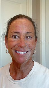 📍For YEARS I was frustrated… I kept slathering on lotions and moisturizers thinking they’d fix my crepey skin. But no matter how much I used, my arms and legs still looked papery, saggy, and dry. I wasted hundreds on expensive creams, body butters, even high-tech LED devices. Nothing actually worked. Then I learned — it was never really about “dryness.” The real issue? 👉 A little-known skin function called Natural Moisturizing Factors (or NMFs). Our skin naturally produces NMFs to keep itself 