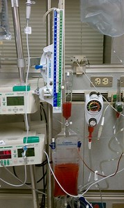 External ventricular drain - Alchetron, the free social encyclopedia