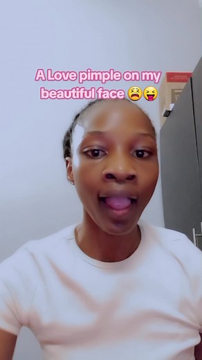 Love Pimple on Face - Location, Meaning, and More