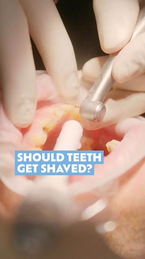 Would you get your teeth shaved? While it's unnecessary for those with healthy teeth, Dr. Deepan Duraisamy explains that for some it’s an opportunity to repair damage and get a new smile. It’s also part of the veneer fitting process, which leaves patients with a permanent and aesthetic set of teeth. | The House Of Wellness