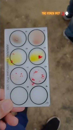 lab life|lab technician reel #bmlt #experiment #dmlt