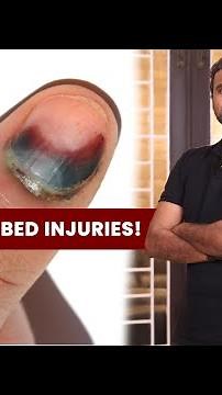 Nail and Nail Bed Injuries | Dr. Sree Charan